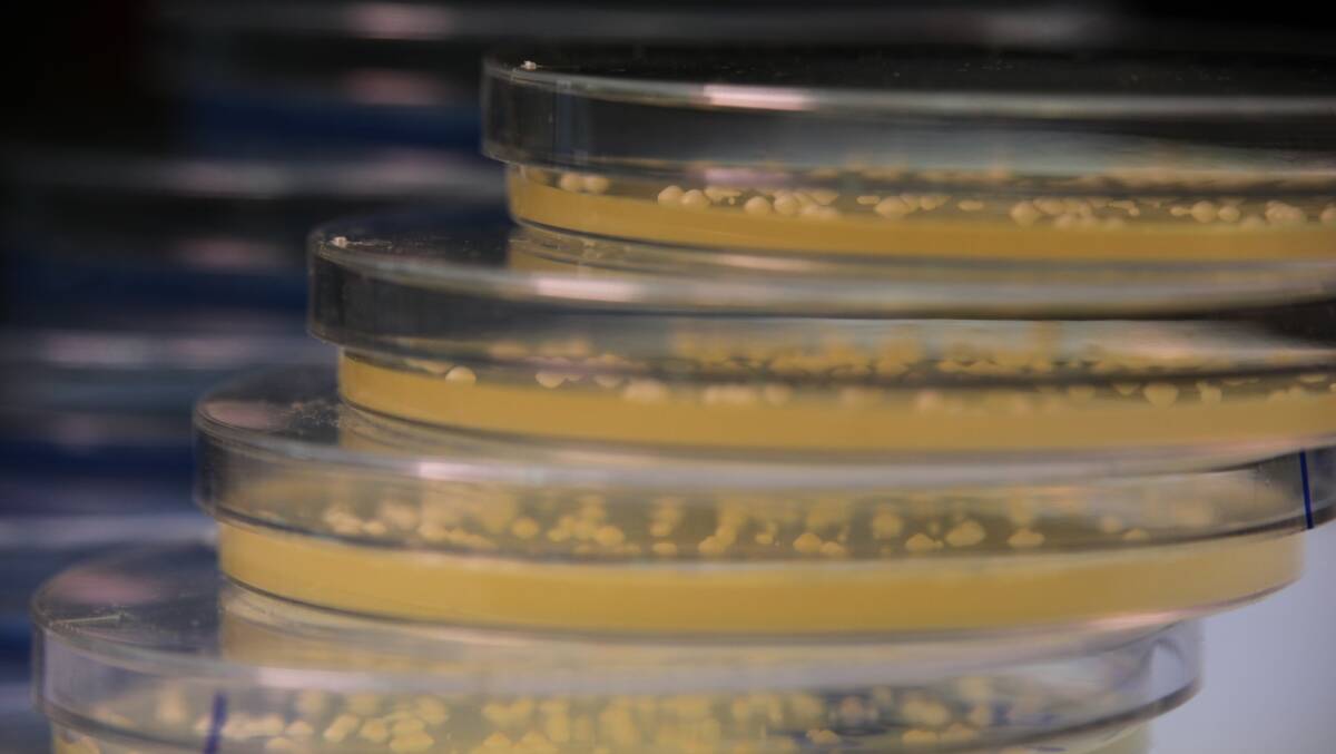 A stack of petri dishes containing MicroBioGen yeast colonies.
